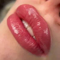 میکروبلیدینگ و شیدینگ تخصصی قیمت ویژه