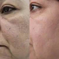 پک ضدجوش وشادابی پوست|آرایشی، بهداشتی، درمانی|نکا, |دیوار