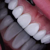 انجام کلیه خدمات دندان پزشکی تخصصی