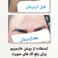 مشاور طب سنتی|خدمات آرایشگری و زیبایی|زابل, |دیوار