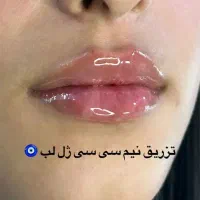 مدل ژل /فیلر /بوتاکس|خدمات آرایشگری و زیبایی|باقرشهر, |دیوار
