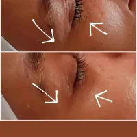 پاکسازی وآبرسانی پوست باتخفیف|خدمات آرایشگری و زیبایی|مرند, |دیوار