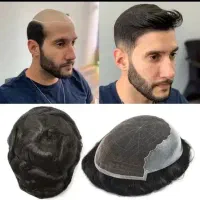 خدمات پروتز و تعویض چسب پروتز