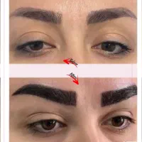 جشنواره تزریق فیلر،بوتاکس ،نخ،لاغری و هایفو|خدمات آرایشگری و زیبایی|تبریز, |دیوار