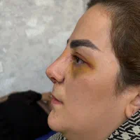 زیبایی بینی|خدمات آرایشگری و زیبایی|شیروان (خراسان), |دیوار