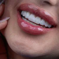 آموزش دندانسازی و کامپوزیت دندان|خدمات آموزشی|کرج, کوی کارمندان شمالی|دیوار