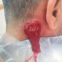 سلامتکده طب سنتی وسوزنی