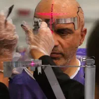 جشنواره کاشت مو