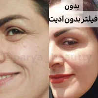 پوستت رو ۲۰ سال جوونتر کن