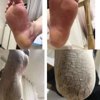 آموزش پدیکور و کفسابی ۹۹۹|خدمات آرایشگری و زیبایی|شاهینشهر, مخابرات (شهید بهشتی)|دیوار