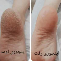 آموزش پدیکوربا نکات طلایی تخفیف ویژه|خدمات آرایشگری و زیبایی|اصفهان, گلزار|دیوار