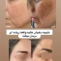 توی خونه تمام لک هاتو درمان کن
