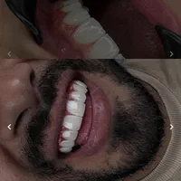 کامپوزیت‌زیبایی‌وایمپلنت‌وعصب‌کشی‌‌دندان|خدمات آرایشگری و زیبایی|تهران, شهید رجایی|دیوار