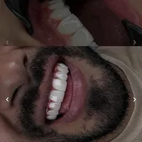 کامپوزیت‌زیبایی‌وایمپلنت‌وعصب‌کشی‌‌دندان|خدمات آرایشگری و زیبایی|تهران, شهید رجایی|دیوار
