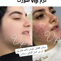 کرم سفیدکننده گیاهیvip|آرایشی، بهداشتی، درمانی|منوجان, |دیوار