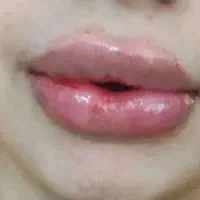زیبایی