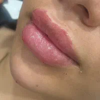 اموزش و مدل تزریق ژل و بوتاکس و فیلر|خدمات آرایشگری و زیبایی|شیراز, معالی‌آباد|دیوار