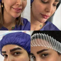 جشنواره ویژه کاشت مو و ابرو|خدمات آرایشگری و زیبایی|رشت, بوسار|دیوار