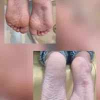 فشیال تخصصی پوست.میکرو بلدینگ.کاشت ناخن.کاشت مژه.