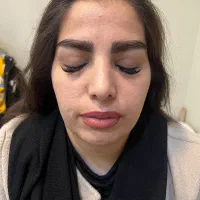 کاشت ابرو تضمینی