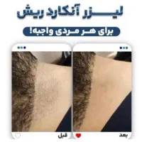 آموزش لیزر موج کندلا مرکز لیزر آقایان لیزر بانوان|خدمات آموزشی|اصفهان, شمس آباد|دیوار