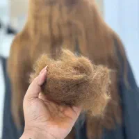 موخوره گیری در ۱ جلسه تضمینی