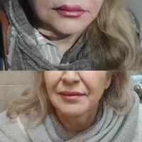 تزریق ژل و فیلر کره ایی تنها با 800 هزارتومان|خدمات آرایشگری و زیبایی|شیراز, عفیف‌آباد|دیوار