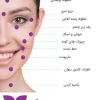 لیزر موهای زاید(رایگان) آقایان بانوان حذف تتو|خدمات آرایشگری و زیبایی|نجف‌آباد, بازار|دیوار