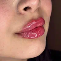 تزریق ژل و بوتاکس و آموزشها