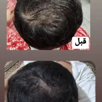 تونیک هیرفند|آرایشگاه و سالن‌های زیبایی|سلماس, |دیوار