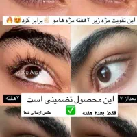 ریمل تقویت مژه و ابرو لاکچری کویین / فرانسوی اصل|آرایشی، بهداشتی، درمانی|تهران, قیطریه|دیوار