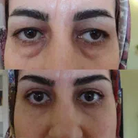 محصولات مراقبت پوستی