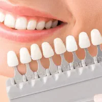 مرکز کامپوزیت، لمینت و ایمپلنت دکتر صبا صباغی|خدمات آرایشگری و زیبایی|شیراز, تاچارا|دیوار
