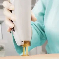 اپراتور لیزر موهای زائد