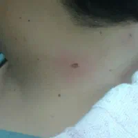 خال برداری|خدمات آرایشگری و زیبایی|ورامین, ورامین|دیوار