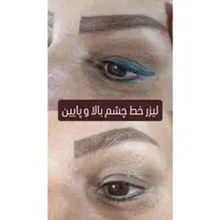مرکز ریمو،پاک کردن،ریموو تتوابرو.بدن.خط چشم بالیزر|خدمات آرایشگری و زیبایی|شیراز, فرهنگ شهر|دیوار