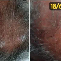 اکسیرپرپشتی مو ،مژه و ابرو|خدمات آرایشگری و زیبایی|گلبهار, شهر جدید گلبهار|دیوار