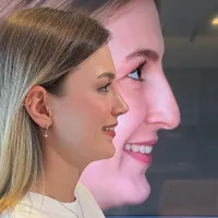 ژل بوتاکس عمل بینی ساکشن چربی در کلینیک بهنود|خدمات آرایشگری و زیبایی|تبریز, |دیوار