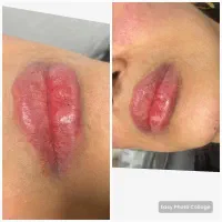 جشنواره تزریق ژل و بوتاکس در کلینیک فقط۶۰۰|خدمات آرایشگری و زیبایی|ساری, |دیوار