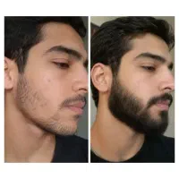 پشمک میشه ریشات باهاش