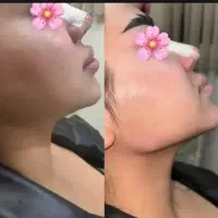 ژل صورت فقط ۱۹۰۰دارای لیبل وزارت بهداشت