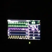 ونکو مایسین