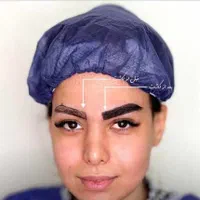 ساکشن غبغب بلفارو کاشت ابرو بوکال فت|خدمات آرایشگری و زیبایی|تهران, میرداماد|دیوار