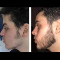 جدید ترین و بروز ترین روش دنیا