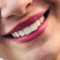 دندانپزشکی و کامپوزیت دندان و دندان مصنوعی|خدمات آرایشگری و زیبایی|تهران, بهداشت|دیوار