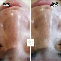 پاکسازی پوست