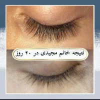مژه ها و ابروهات رو تقویت و زیبا کن|خدمات آرایشگری و زیبایی|شیراز, ارم|دیوار