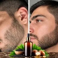 دیگه نگران کم پشتی و خالی بودن ریش هات نباشی|آرایشی، بهداشتی، درمانی|تهران, سنگلج (شاپور)|دیوار