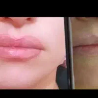 خدمات تخصصی*آرایش دائم *ریموو*|خدمات آرایشگری و زیبایی|کرمانشاه, |دیوار