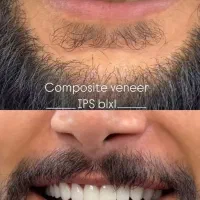 دندانپزشکی.کامپوزیت.عصب کشی.ایمپلنت.جرمگیری